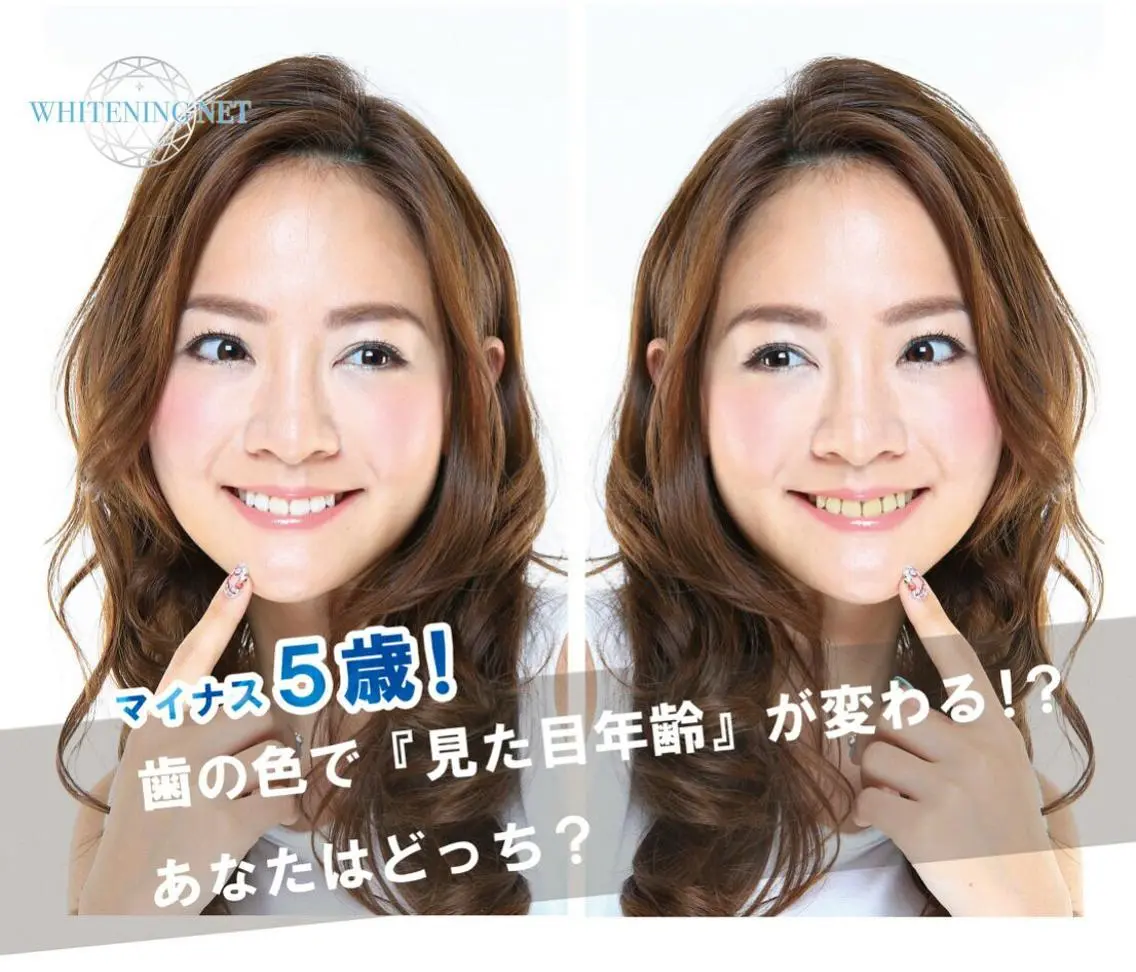 超お得！！【１Day　ホワイトニングプラン】①美白歯ハミガキ粉 ②美白歯マウストリートメント　付きの写真