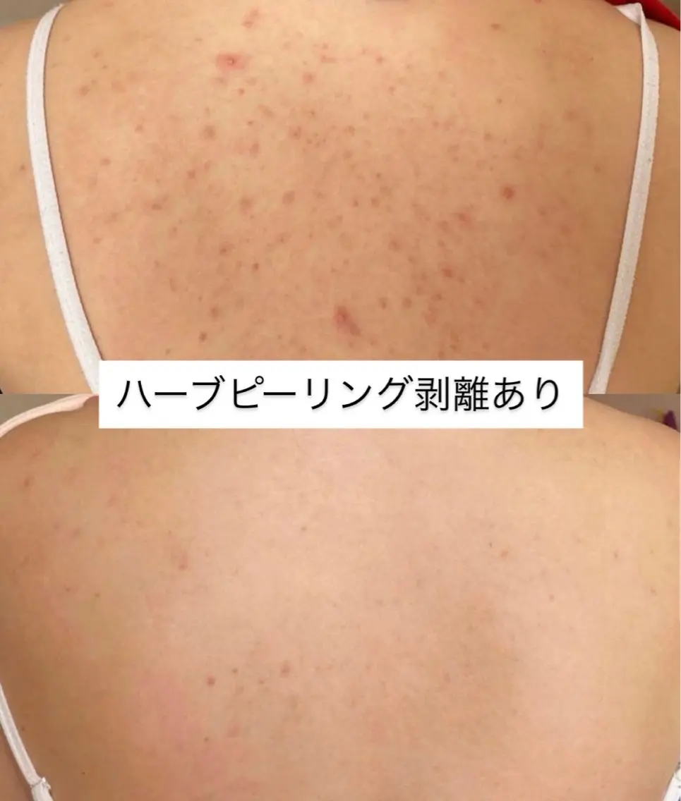 エステ Soin 身体&お肌ケアのエステ・リラクイメージ