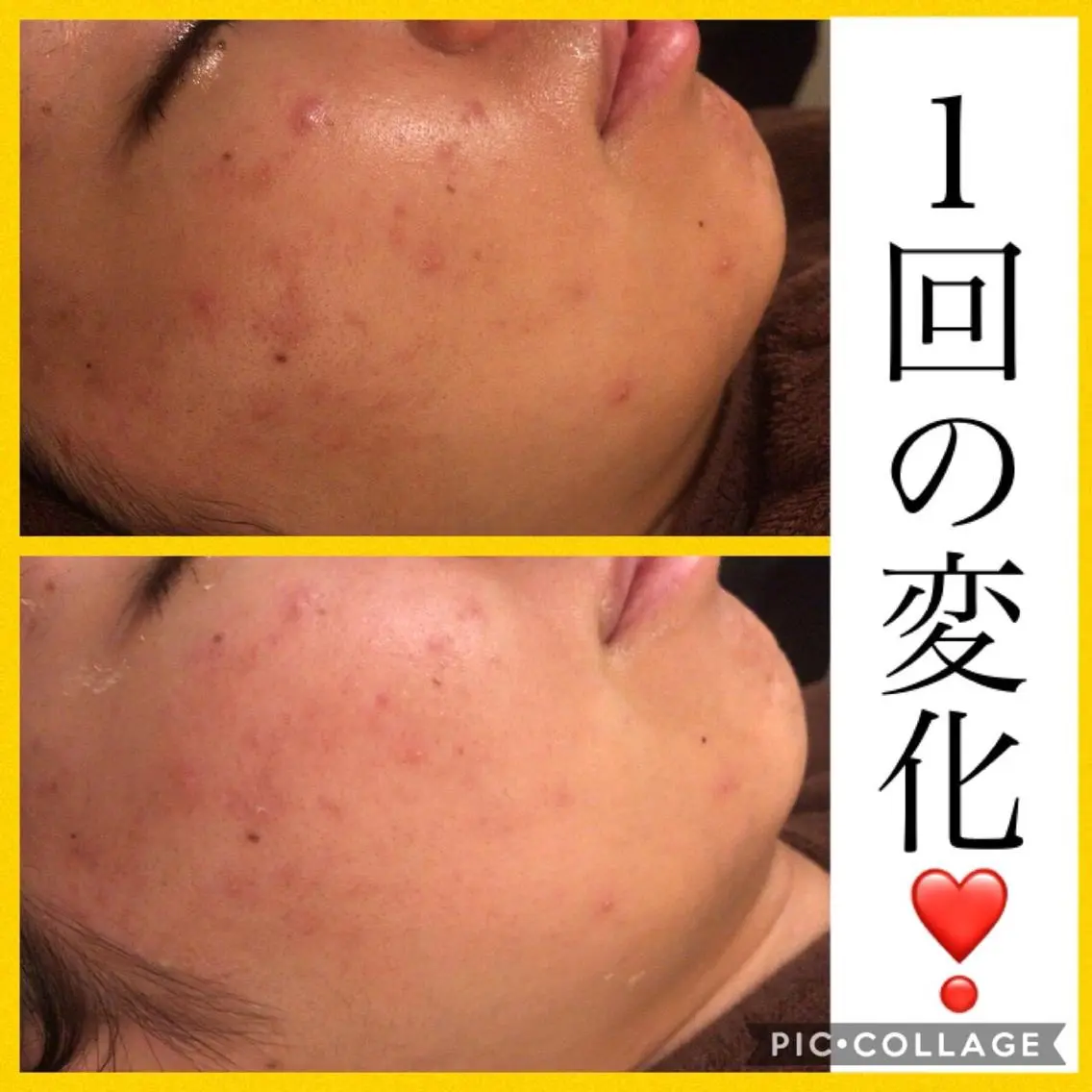 ミディアム カラー パーマ ヘアアレンジ メンズ キッズ ネイル マツエク・マツパ ニキビ・肌質改善専門 ♡人生が変わるサロンのエステ・リラクイメージ