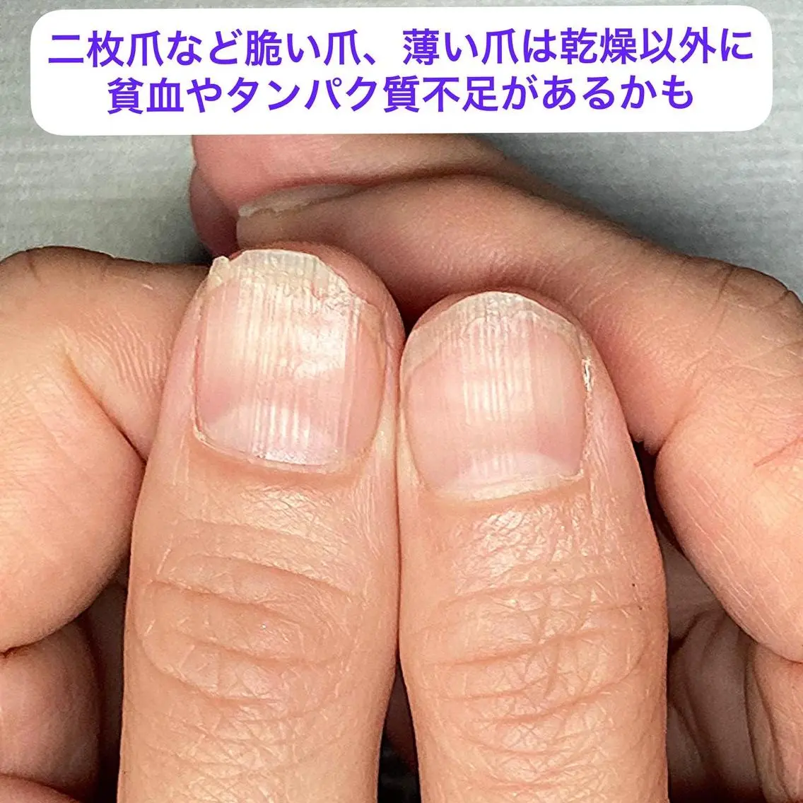 メンズ ネイル ケアリスト🍀 マリユキのネイルデザイン