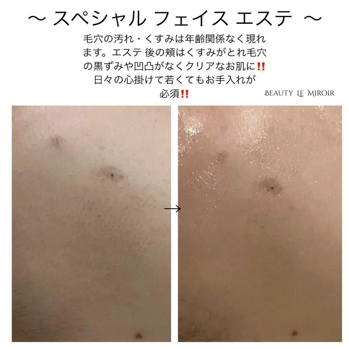 マツエク・マツパ ビューティー ミロワールのエステ・リラクイメージ