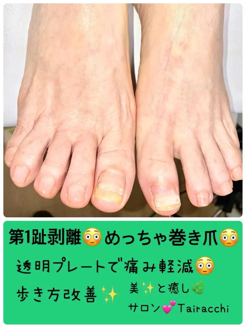ネイル フットネイル Tairacchi ﾀｲﾗｯﾁのネイルデザイン