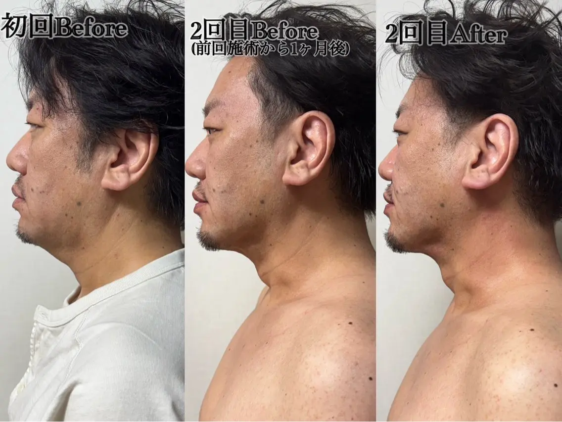 六本木脱毛andS Saoriのエステ・リラクイメージ