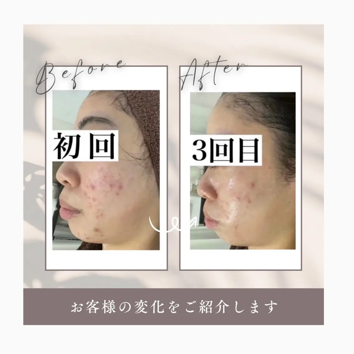 Horishia 福岡博多店のエステ・リラクイメージ