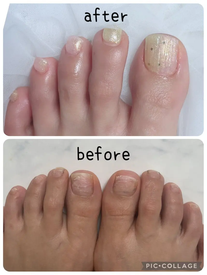 foot nail🦶の写真