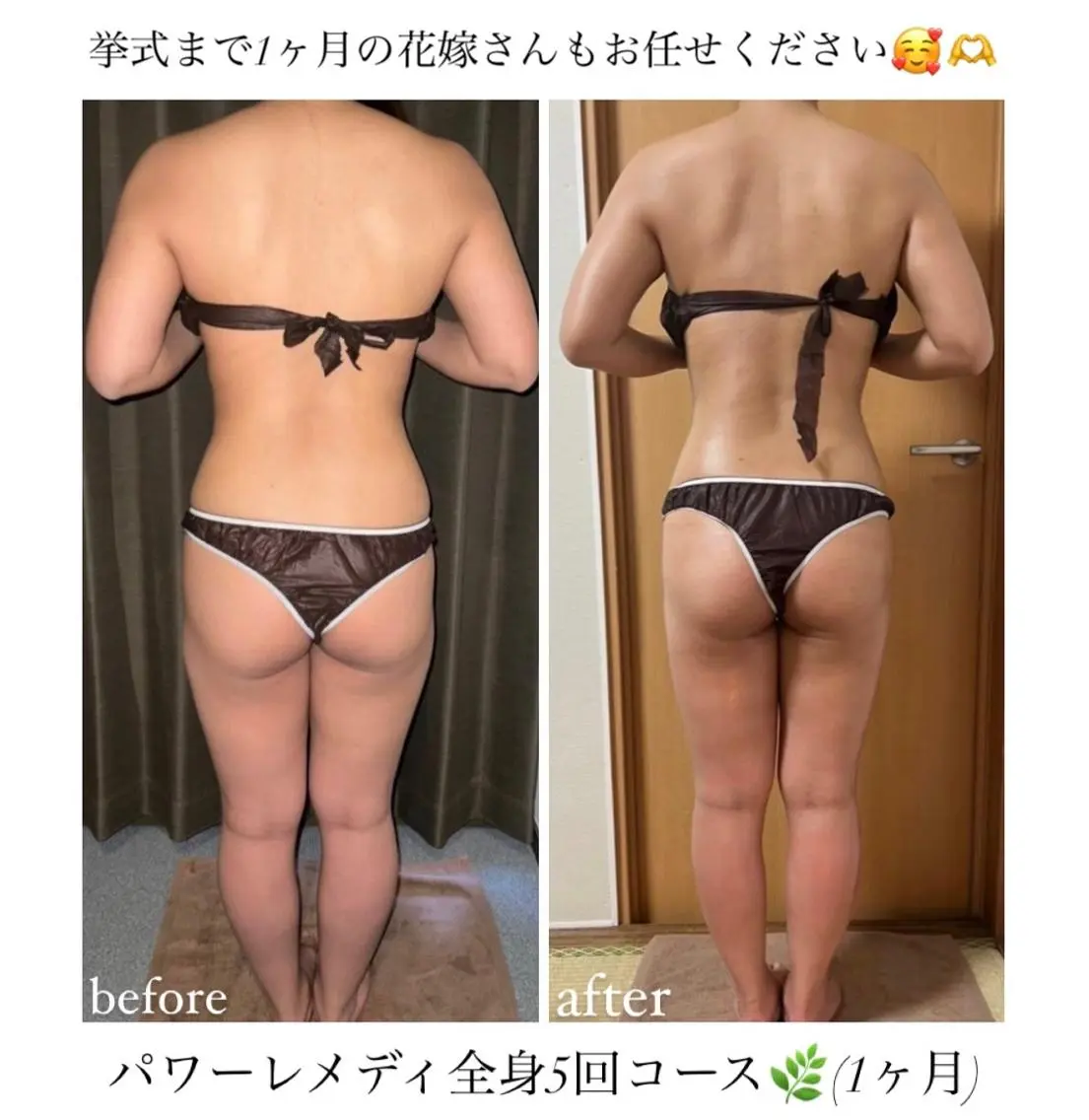 《本気痩せ×疲労改善 》 BILOOPのエステ・リラクイメージ