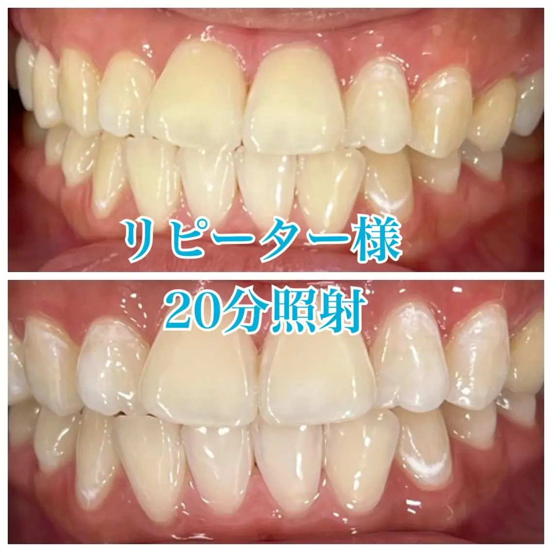 ホワイトニング🦷 ネイル💅LEAのその他イメージ
