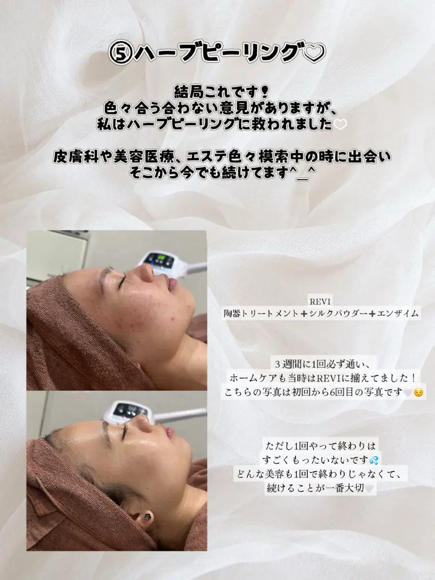 エステ 艶肌デトックス🫧 Samiraのエステ・リラクイメージ