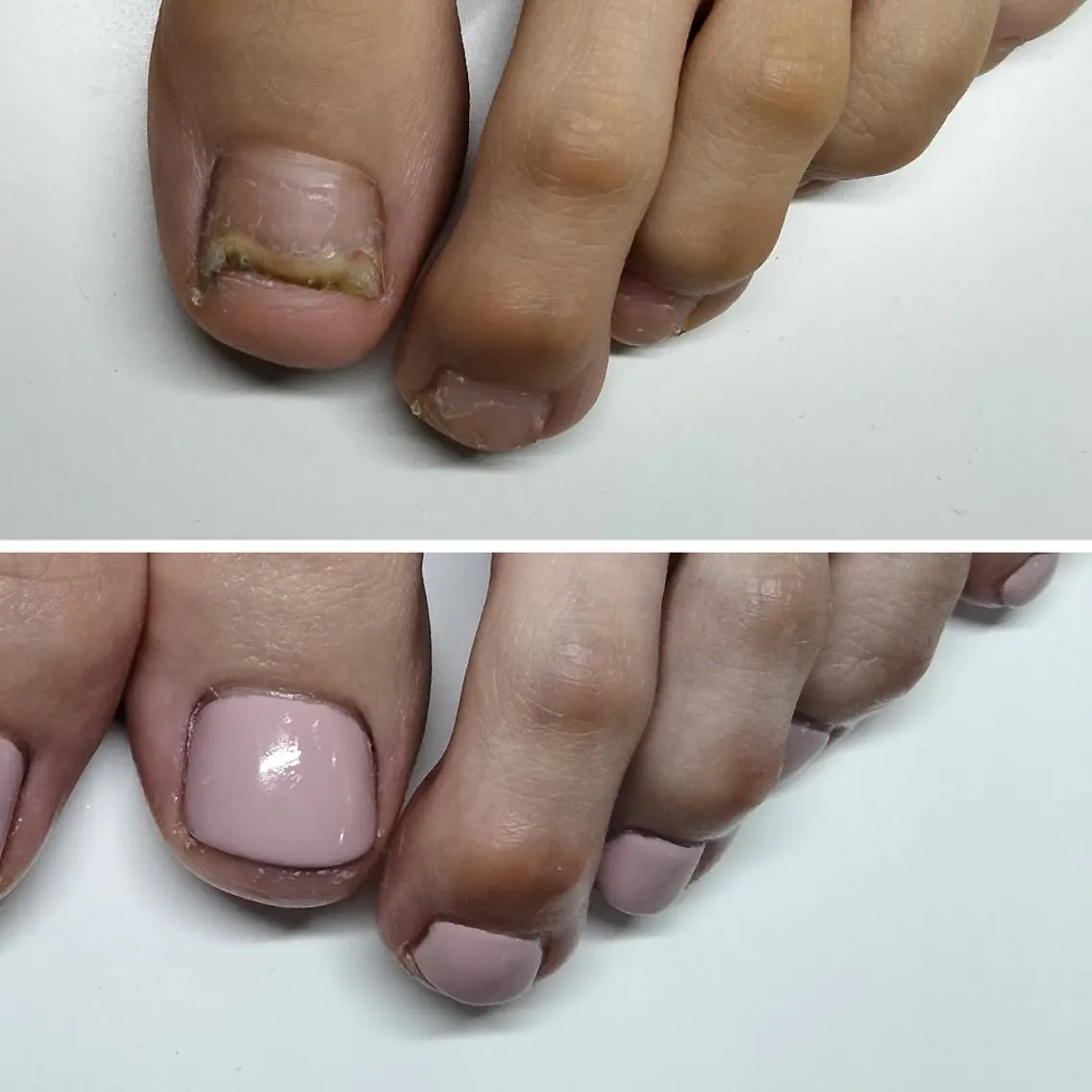 ネイル ネイルサロン アリュームのネイルデザイン