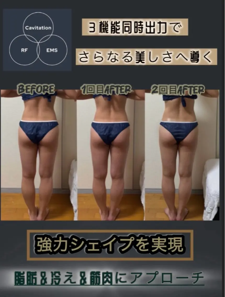 エステ ヴィーナス ビューティーのエステ・リラクイメージ