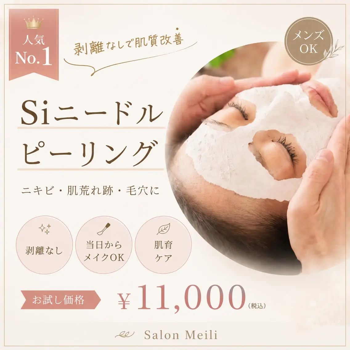 【人気No.1】剥離なしSiニードルピーリング｜ニキビ・ニキビ跡・毛穴 ¥11,000の写真