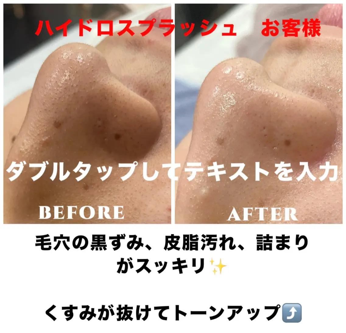エステ リラク ネイル・エステサロン UILANIのエステ・リラクイメージ