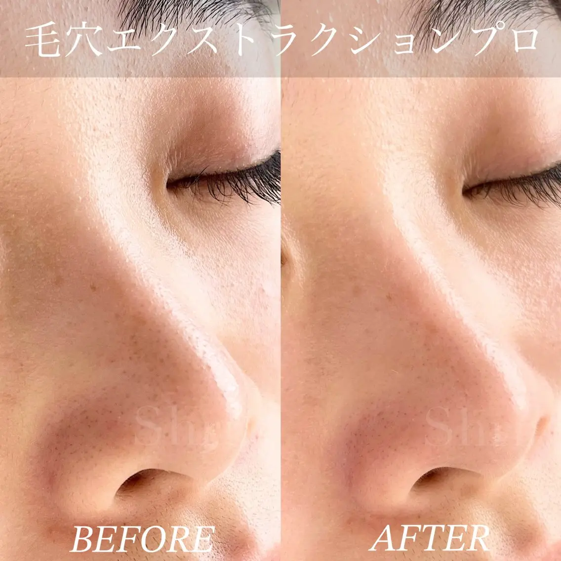 エステ salon Shriのマツエク・マツパデザイン