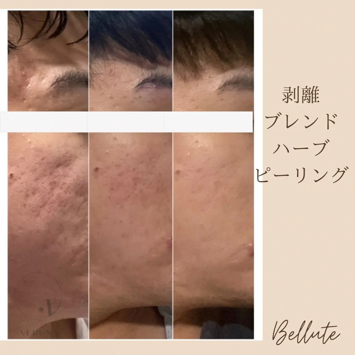 エステ リラク ピーリング専門店 Belluteのエステ・リラクイメージ