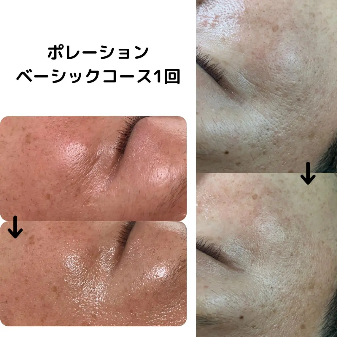 ミューズエステ 谷口美結のエステ・リラクイメージ