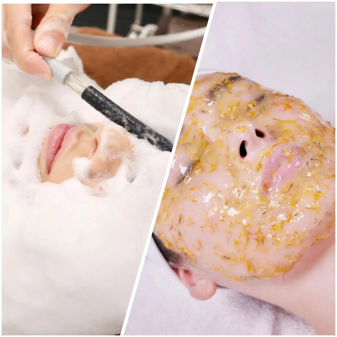 🌼平日限定🌼ラテスパ+ハイドロジェリーマスク《毛穴/黒ずみ/美白/ツヤ》の写真