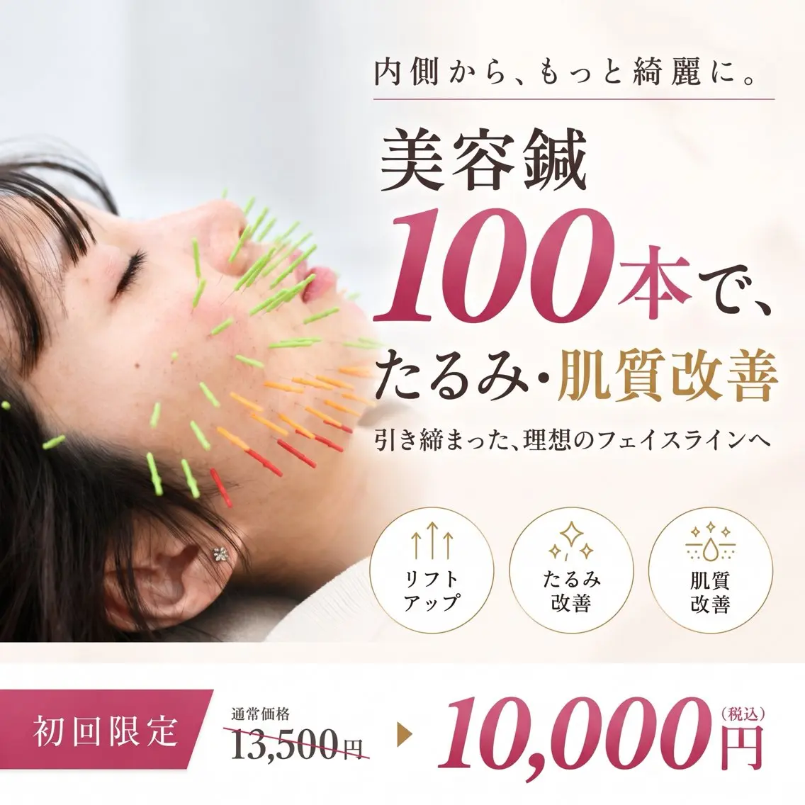 【人気No.2メニュー】百美鍼:美容鍼100本(リフトアップ/小顔/ほうれい線/しわ/たるみ/毛穴の開き)(70分)の写真