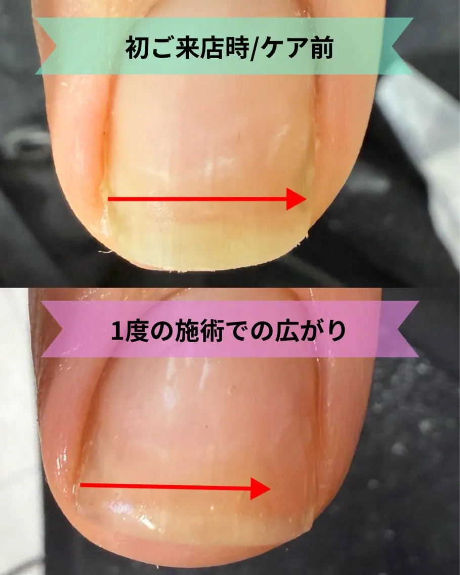ネイル ネイルケアサロン Campanulaのネイルデザイン