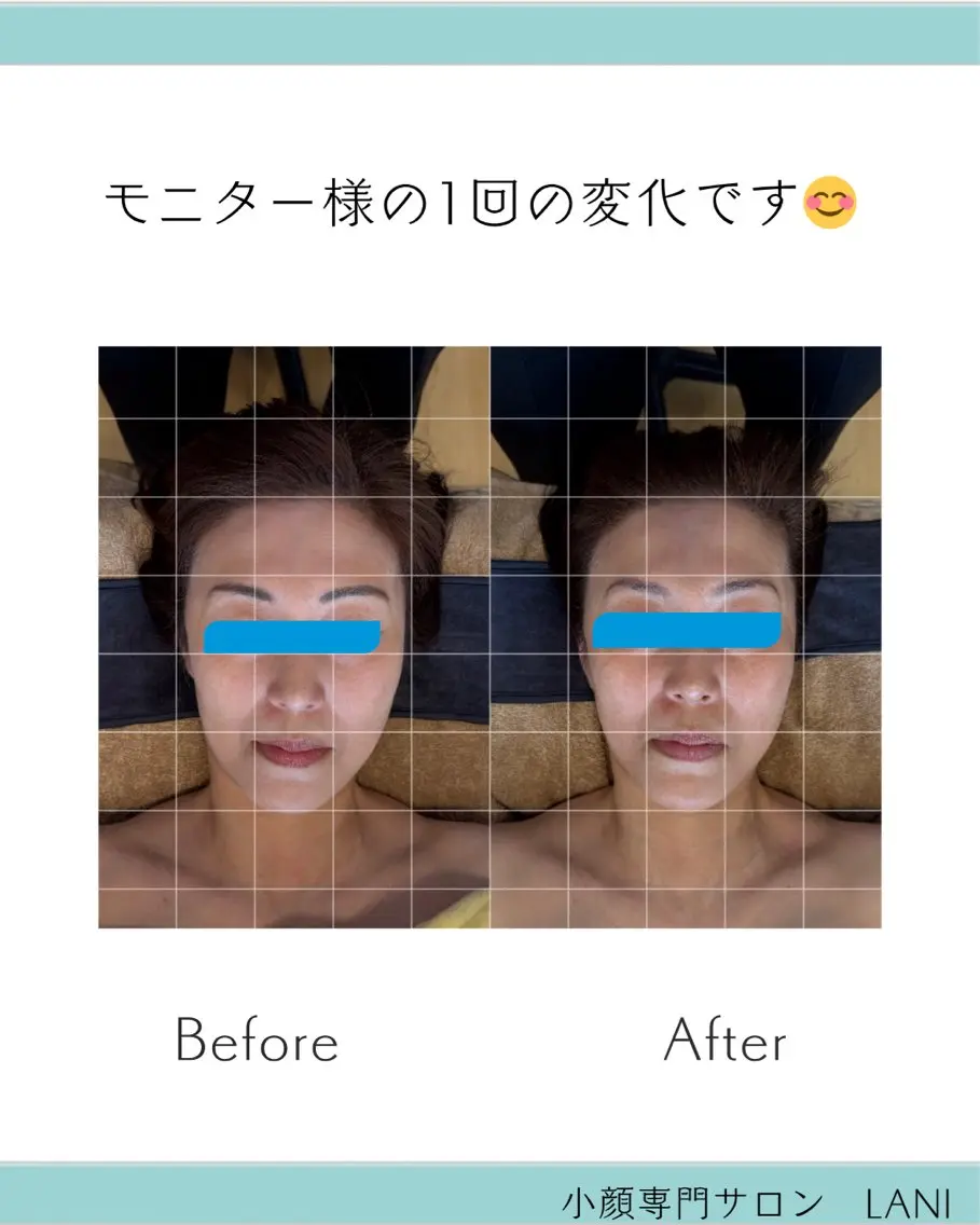 小顔専門サロン MAIのエステ・リラクイメージ