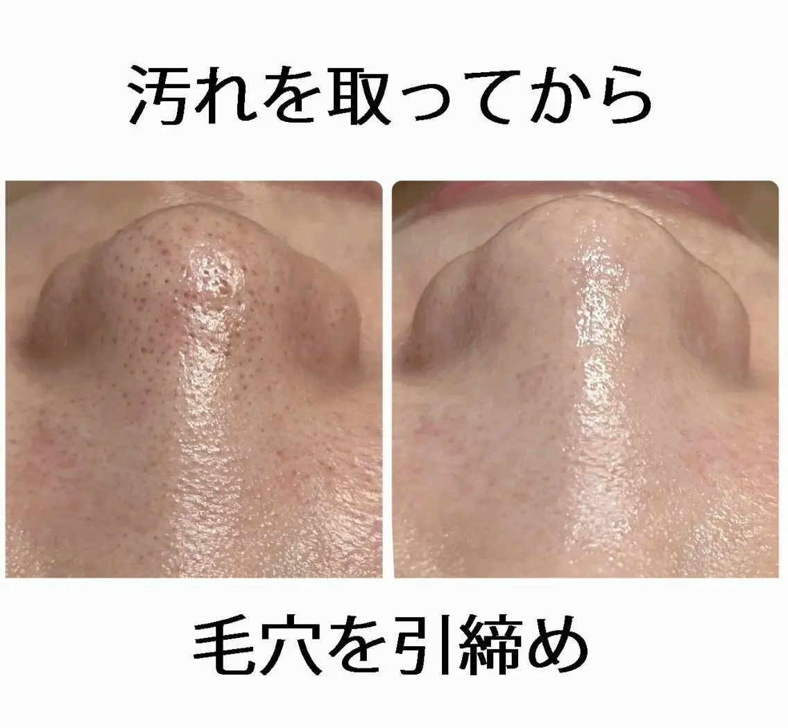 MI SUZUのエステ・リラクイメージ