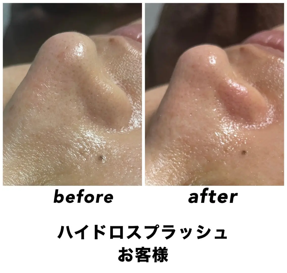 エステ リラク ネイル・エステサロン UILANIのエステ・リラクイメージ