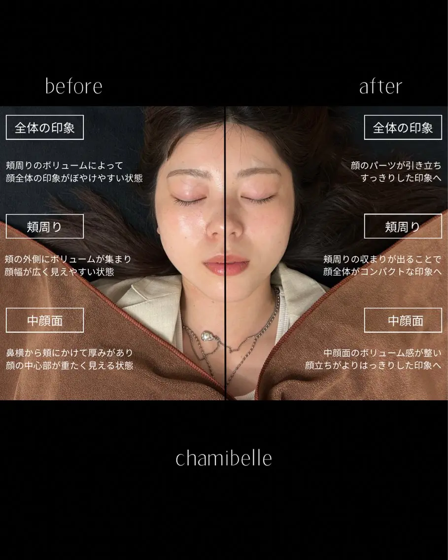 美容鍼灸サロン Chamibelleのエステ・リラクイメージ