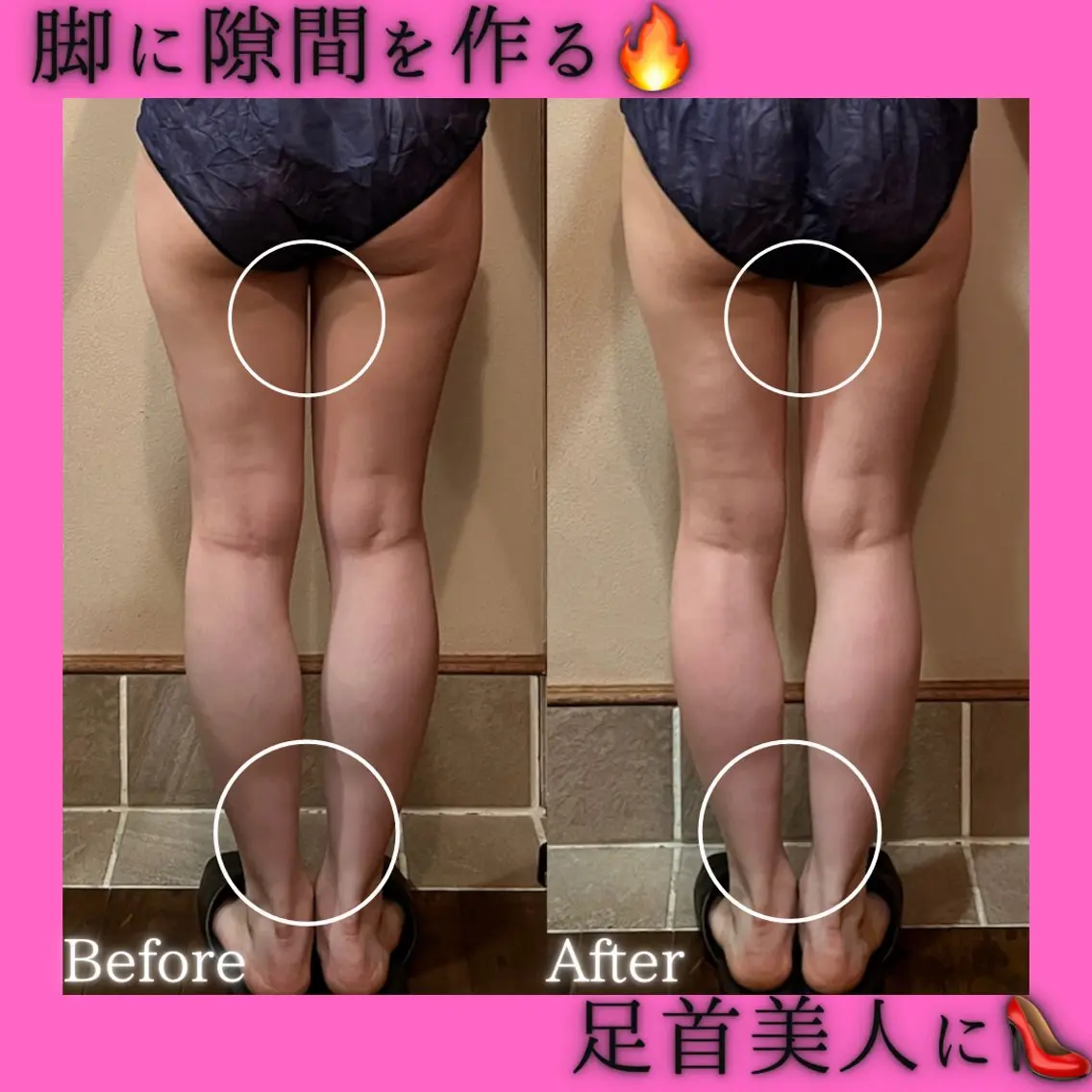 痩身&美肌サロン 堀米✨のその他イメージ
