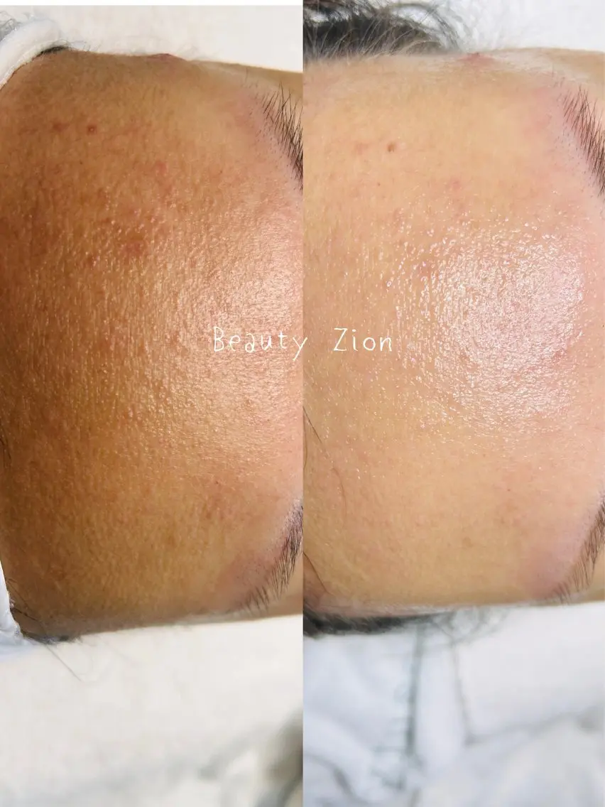 Beauty Zionのエステ・リラクイメージ