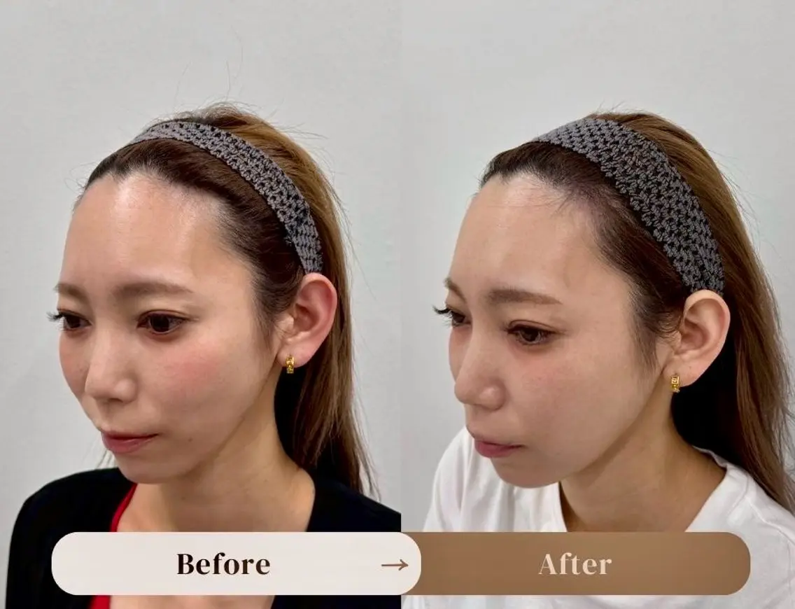 【体験メニュー】貴方の気になるところをヘアアートでお悩み解消🤩の写真