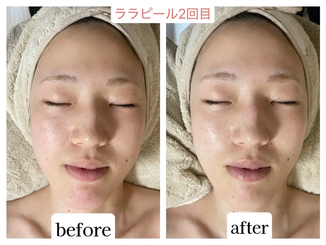 💜Karen PrivateSpaのエステ・リラクイメージ