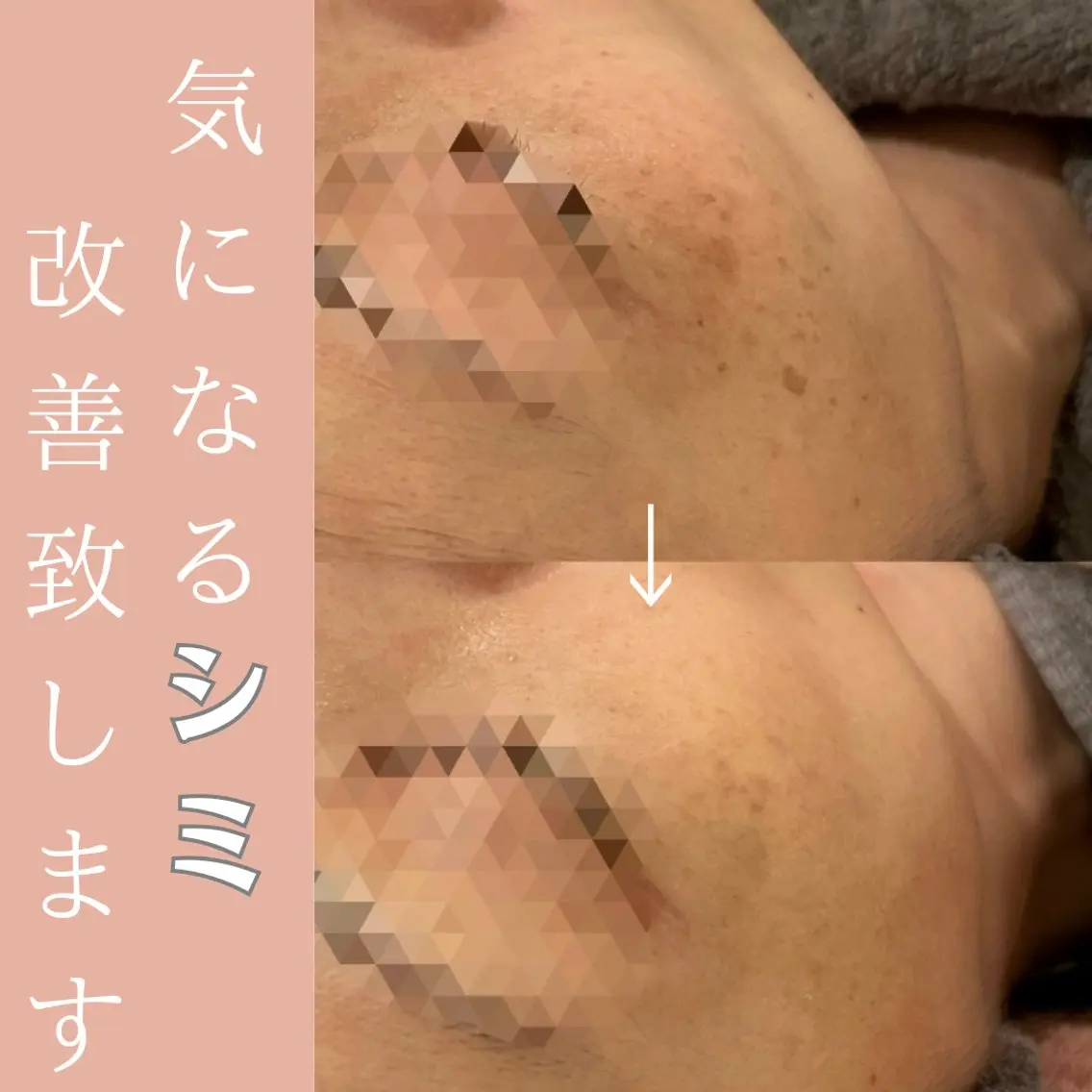 ラシュシュ 茨木のエステ・リラクイメージ