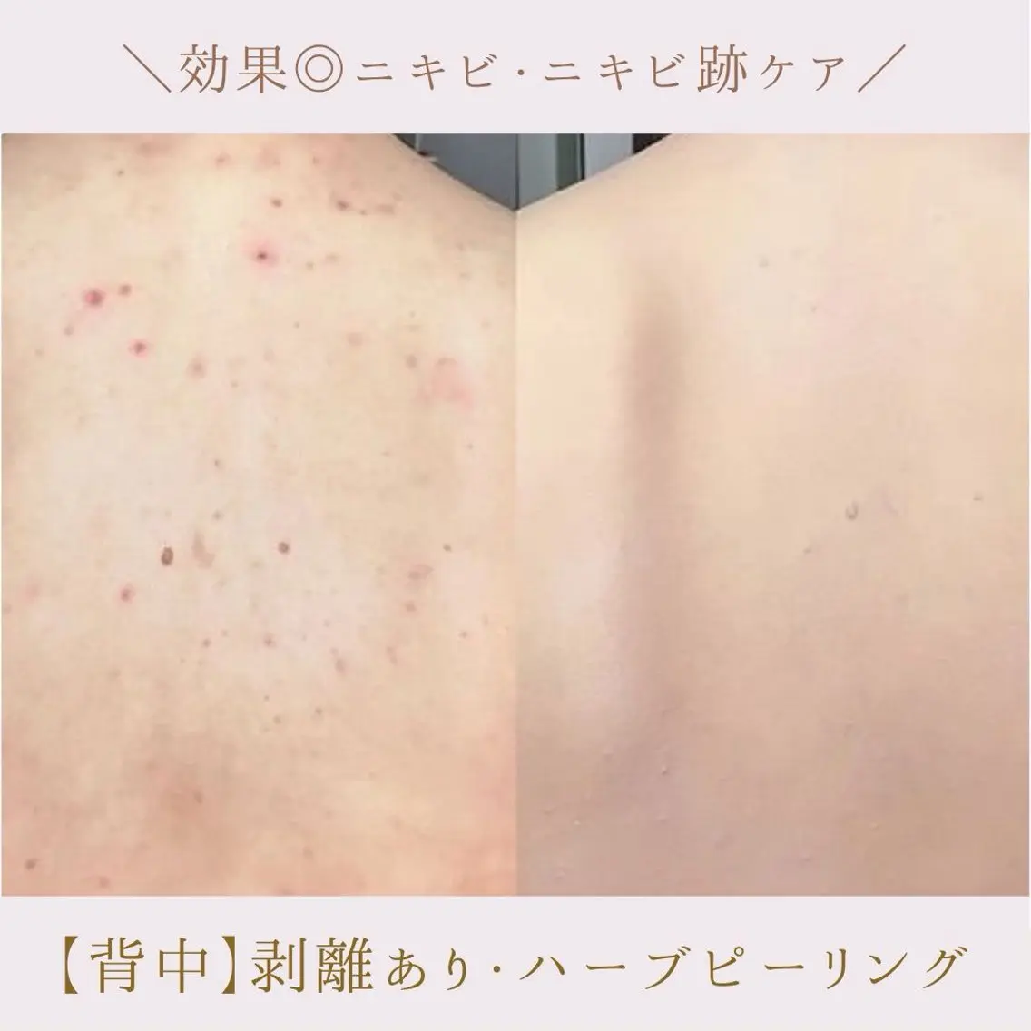 肌質改善サロン renew/ｳｴｷのエステ・リラクイメージ