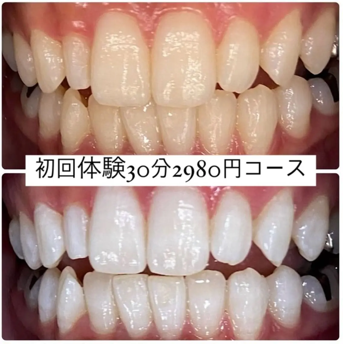 ホワイトニングルーム 横浜店のその他イメージ