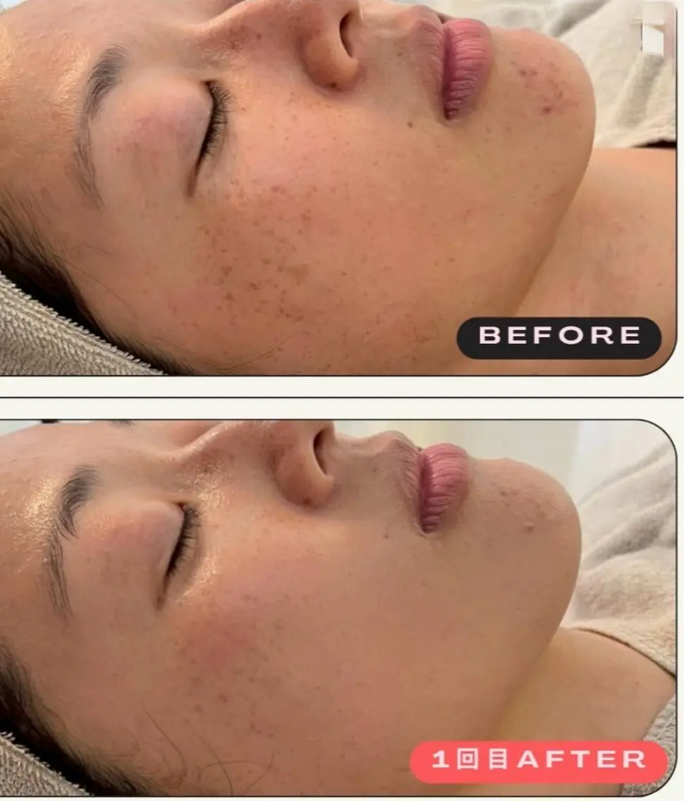 facial salon D 吉沢のエステ・リラクイメージ