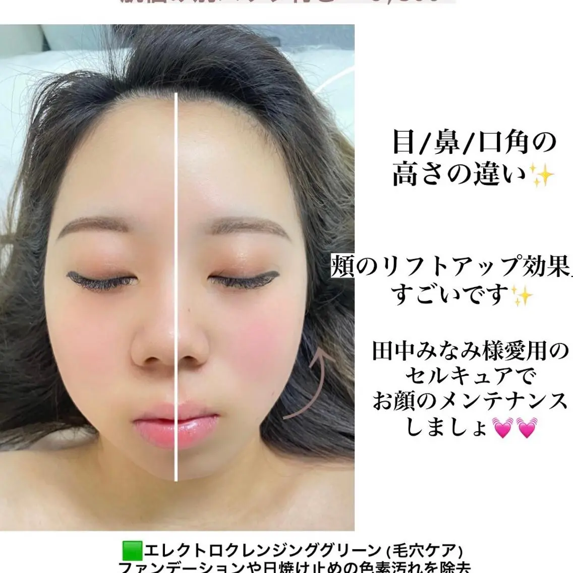 エステ 🤍SÉALIE⟡. ｼｱﾘｰ脱毛サロンのエステ・リラクイメージ