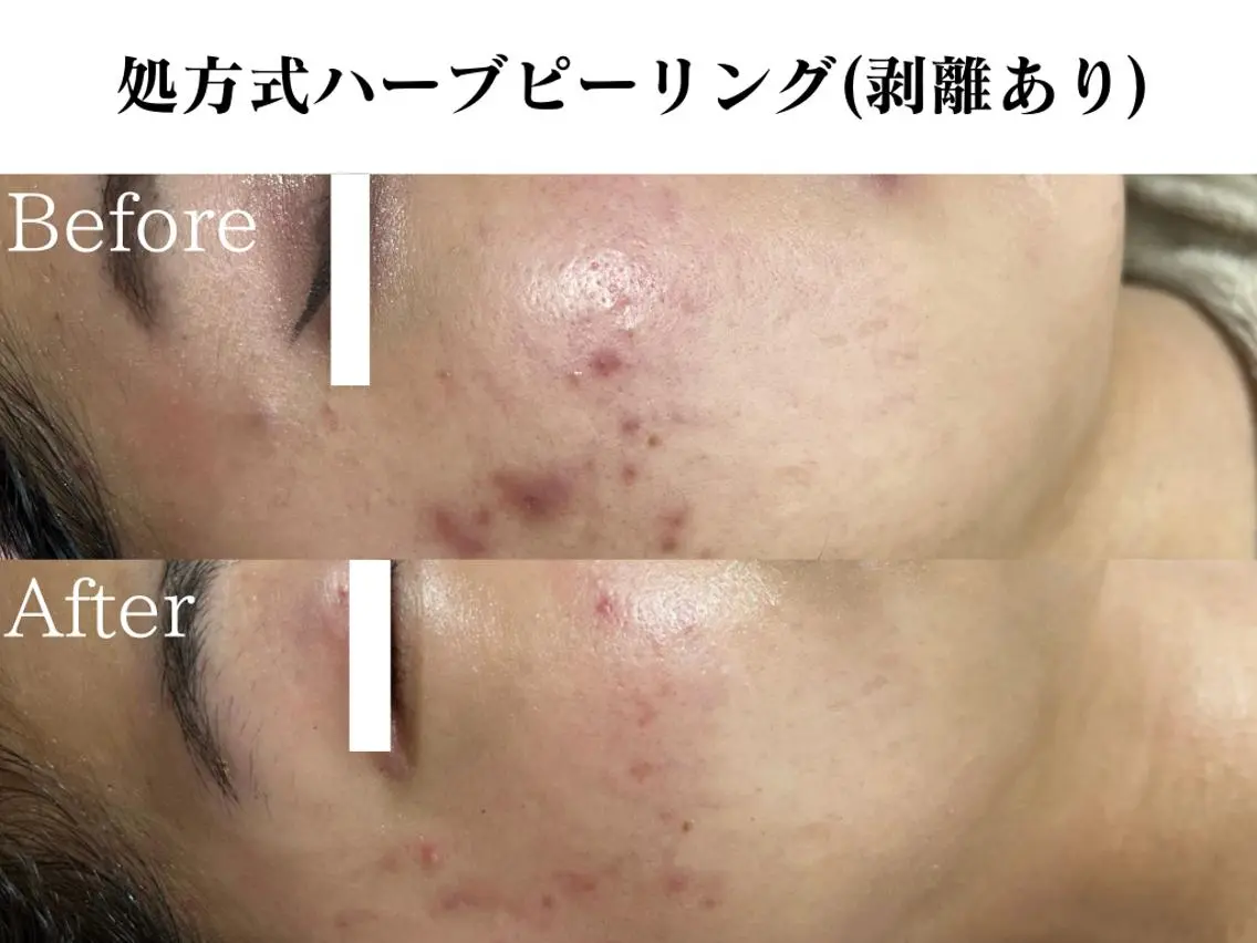 エステ リラク 🌿OmoteAri 心斎橋✨エステサロンのエステ・リラクイメージ