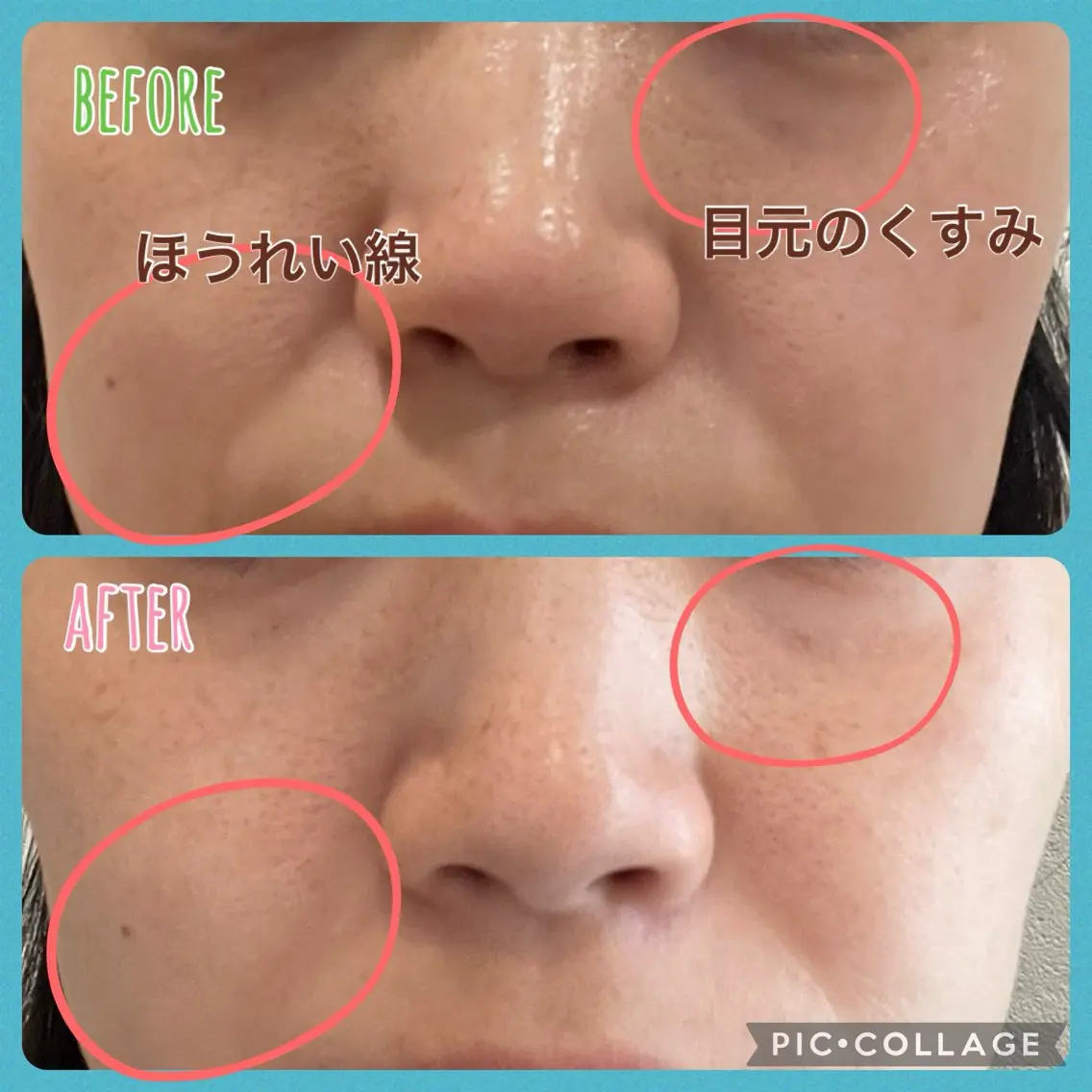 エステ 清水 慎子のその他イメージ