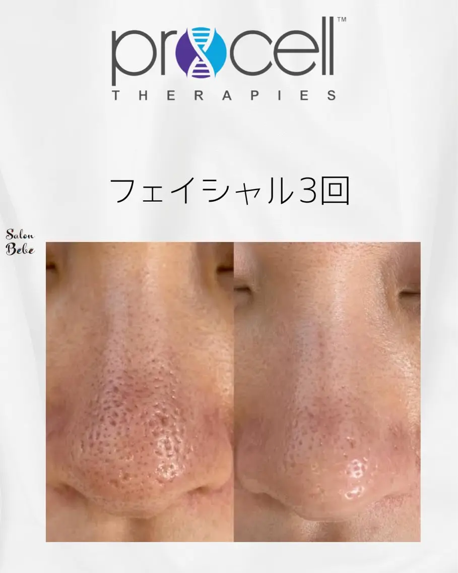 エステ Salon Bebe 名古屋のエステ・リラクイメージ
