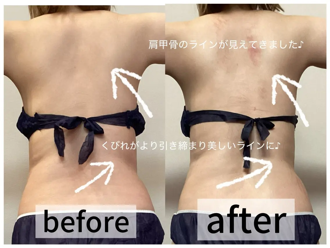 エステ 浮腫|肩こり|張り 日々の疲れを解消★のエステ・リラクイメージ