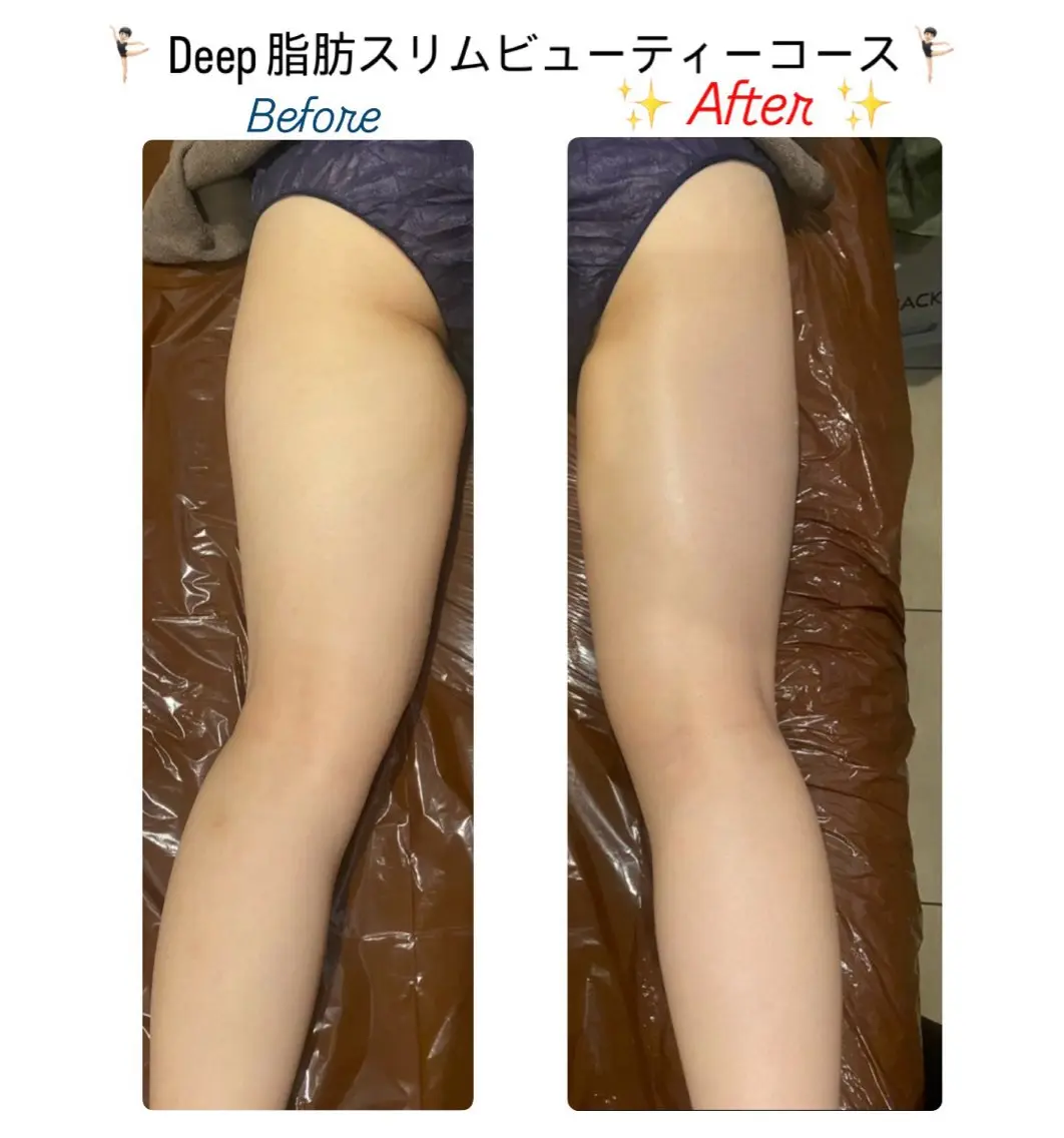 エステ ル プランタン 🌿 友唯南のエステ・リラクイメージ