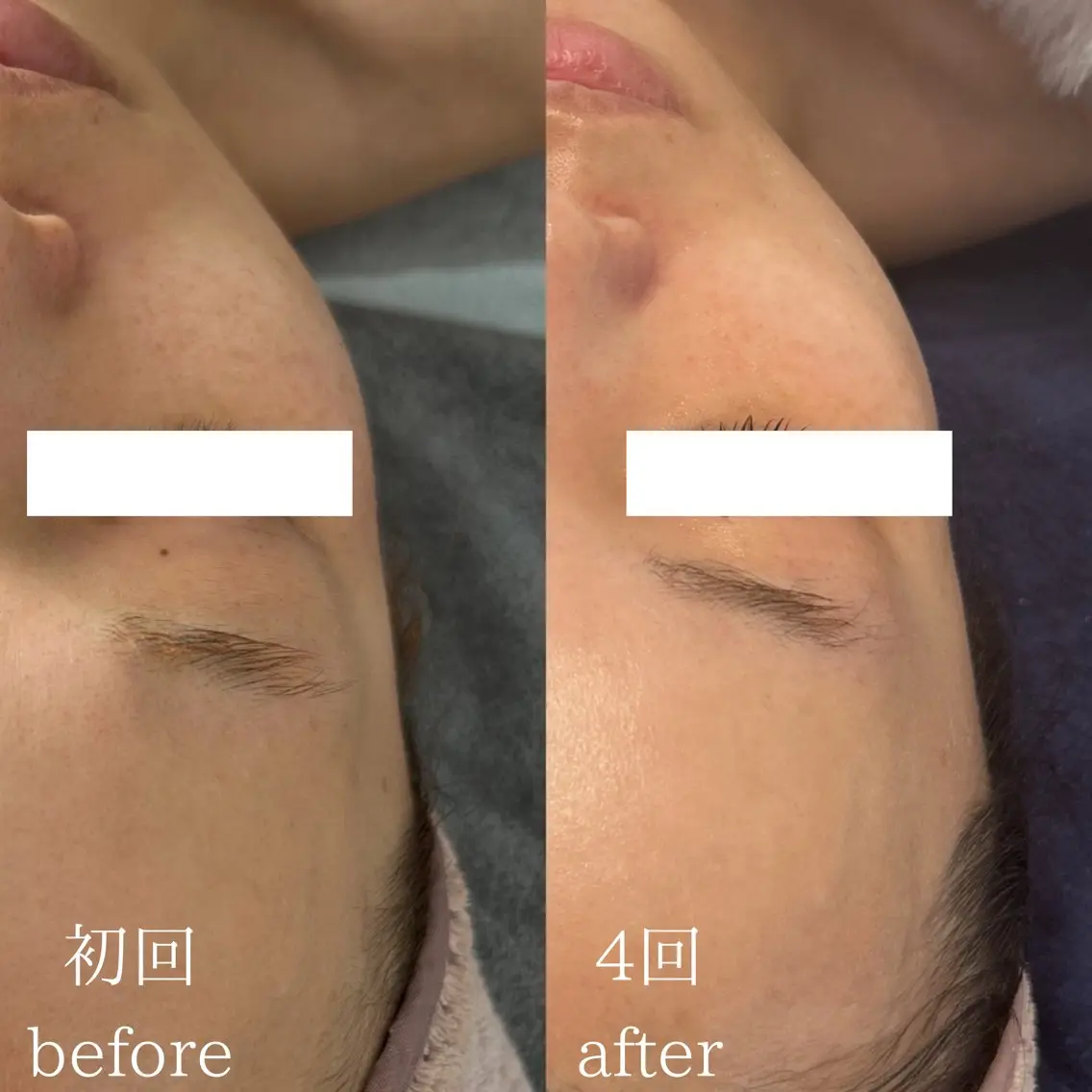 エステ Le cherienのエステ・リラクイメージ