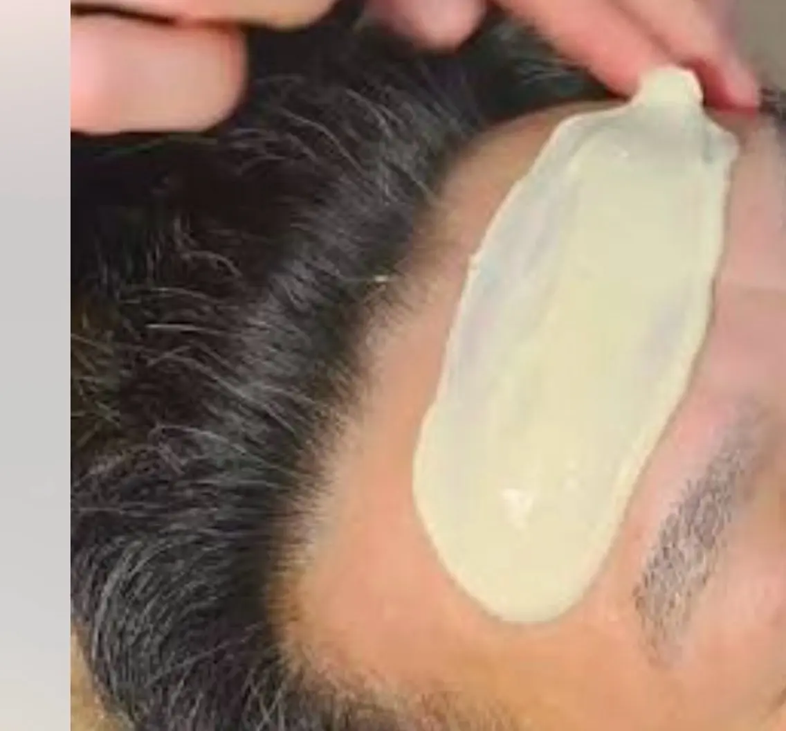【メンズ】【WAX脱毛】フェイシャルWAXの写真