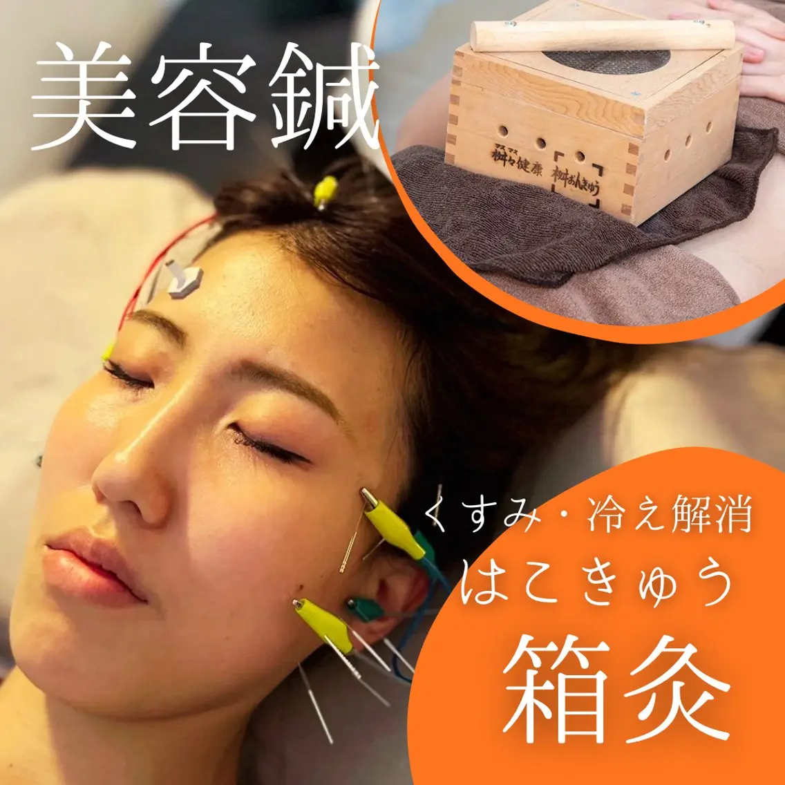 【美容鍼×箱灸】芯から整える美活ケア✨むくみ/くすみ/ほうれい線/たるみ/冷え🎶の写真