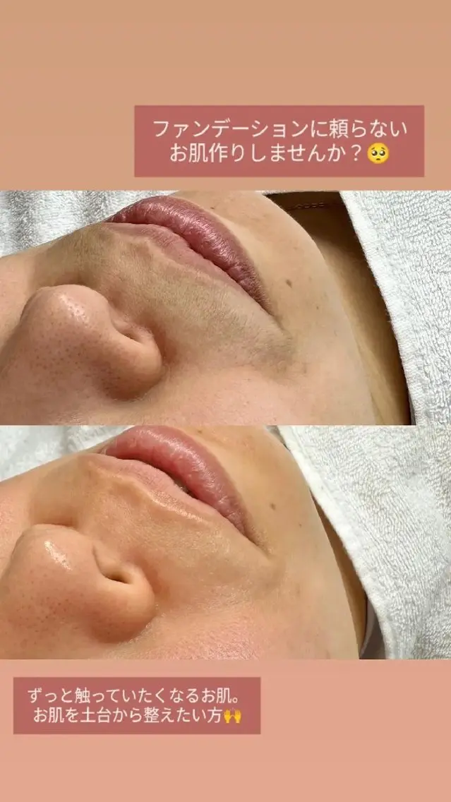 学生割(U24)ずっと触りたくなる艶肌！水光肌WAX＋Sango高濃度炭酸パックの写真