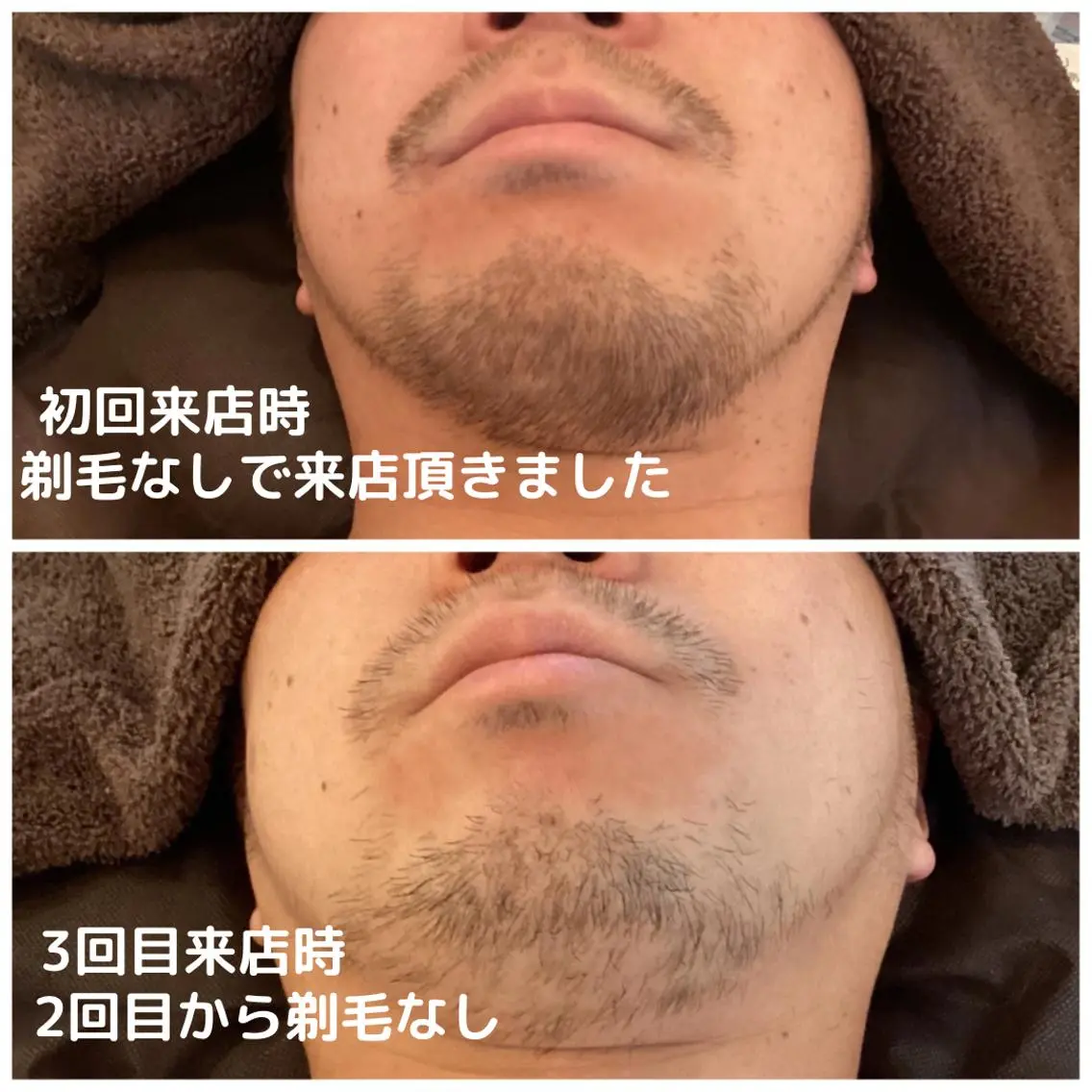 メンズ men's脱毛サロン ECXIAのエステ・リラクイメージ