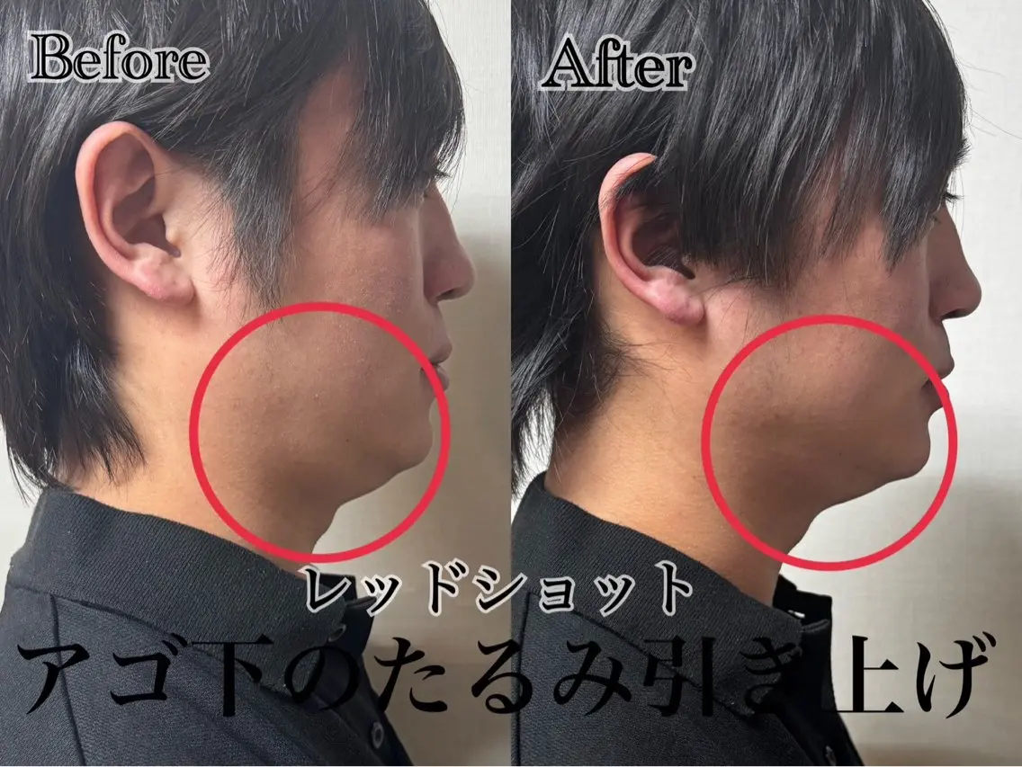 六本木脱毛andS Saoriのエステ・リラクイメージ