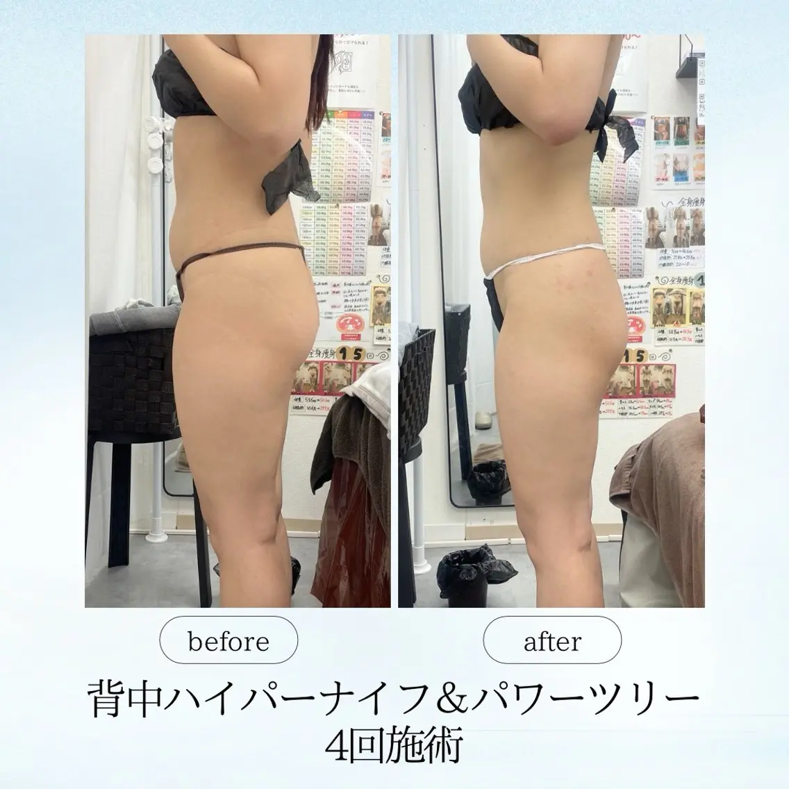 エステ リラク 《痩身、小顔専門店》 エスプレッソのエステ・リラクイメージ
