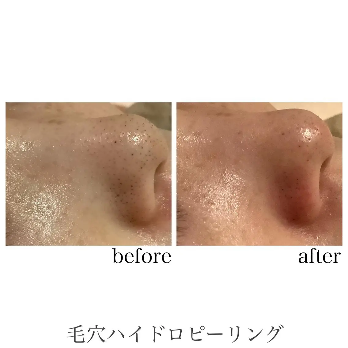 エステ 脱毛&エステサロン JIGGLY武蔵小山のエステ・リラクイメージ