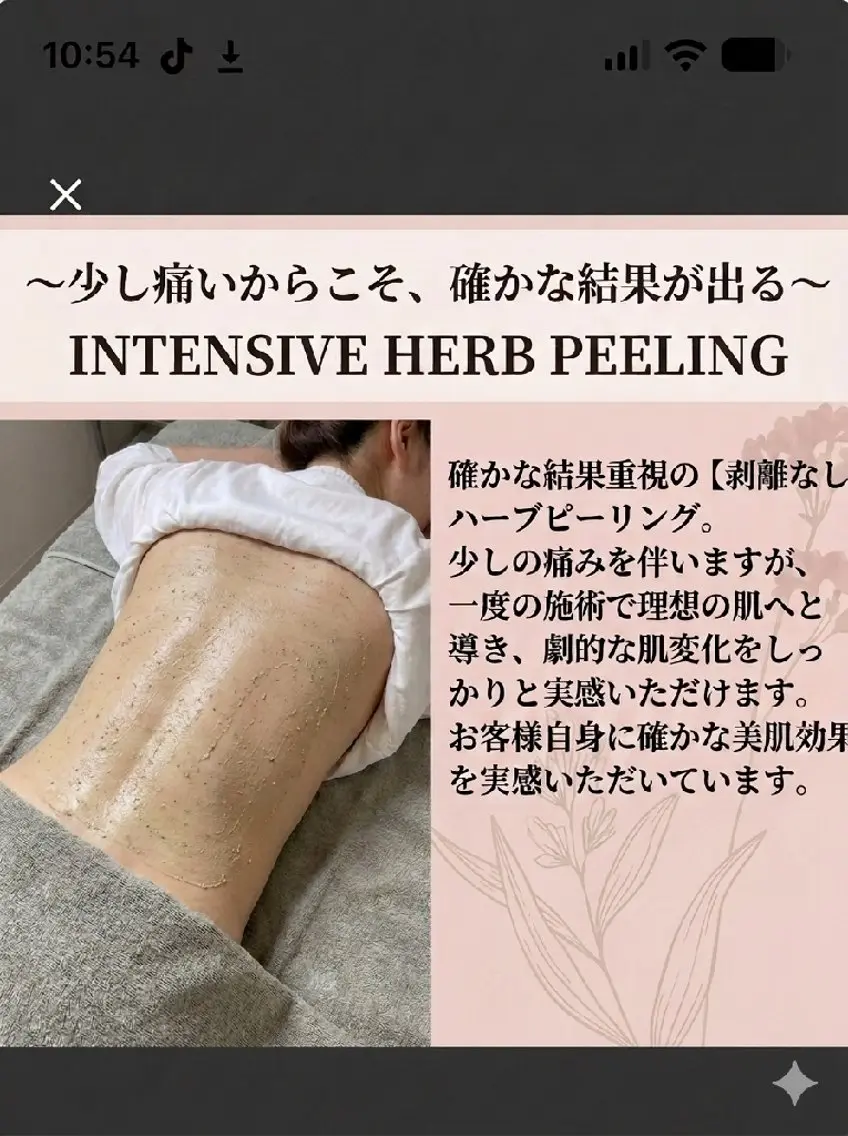 【背中ニキビ・跡ケア🌿】天然クレイハーブピーリング 背中見せ服の準備に✨の写真