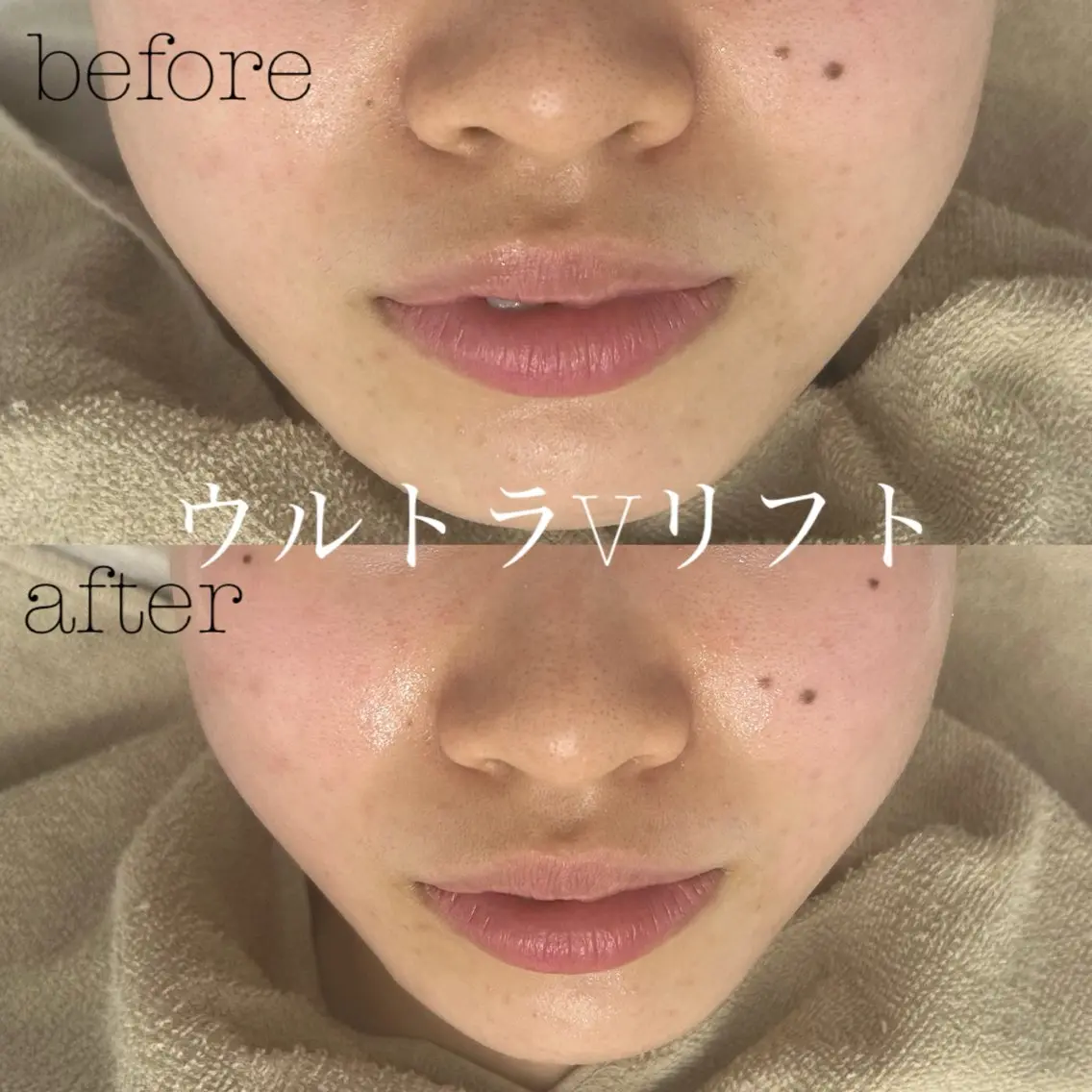 エステ フェイシャルサロン CHIARA 荒田のエステ・リラクイメージ